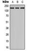 Collagen Type IV Alpha 2 Chain antibody, LS-B13713, Lifespan Biosciences, Western Blot image 