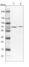 Protein Phosphatase 2 Regulatory Subunit B'Gamma antibody, NBP1-88961, Novus Biologicals, Western Blot image 