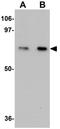 Tectonic Family Member 1 antibody, GTX85178, GeneTex, Western Blot image 