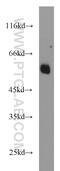 BCS1 Homolog, Ubiquinol-Cytochrome C Reductase Complex Chaperone antibody, 10175-2-AP, Proteintech Group, Western Blot image 