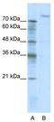 ZHX2 antibody, TA343762, Origene, Western Blot image 
