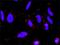 Frizzled Class Receptor 5 antibody, H00007855-M01, Novus Biologicals, Proximity Ligation Assay image 