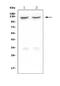 Integrin Subunit Alpha 2b antibody, PB9647, Boster Biological Technology, Western Blot image 