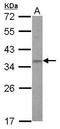 Zinc Finger Protein 501 antibody, PA5-30734, Invitrogen Antibodies, Western Blot image 
