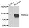 Protein Kinase C Gamma antibody, A7922, ABclonal Technology, Western Blot image 