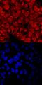 Testis-expressed sequence 19 protein antibody, PA5-48099, Invitrogen Antibodies, Immunocytochemistry image 