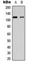 Hexokinase 1 antibody, orb256602, Biorbyt, Western Blot image 