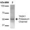 Potassium Two Pore Domain Channel Subfamily K Member 3 antibody, 11578, QED Bioscience, Western Blot image 