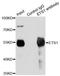 ETS Proto-Oncogene 1, Transcription Factor antibody, LS-C748358, Lifespan Biosciences, Immunoprecipitation image 