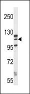 MORC Family CW-Type Zinc Finger 1 antibody, PA5-71823, Invitrogen Antibodies, Western Blot image 