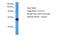 Maestro Heat Like Repeat Family Member 7 antibody, A14010, Boster Biological Technology, Western Blot image 