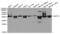 Septin 2 antibody, TA332924, Origene, Western Blot image 