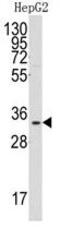 Complement C1q Binding Protein antibody, GTX81280, GeneTex, Western Blot image 