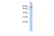 Transmembrane And Tetratricopeptide Repeat Containing 1 antibody, GTX46121, GeneTex, Western Blot image 