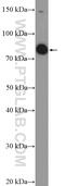 SP140 Nuclear Body Protein Like antibody, 19845-1-AP, Proteintech Group, Western Blot image 