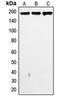 DNA Topoisomerase II Alpha antibody, LS-B16084, Lifespan Biosciences, Western Blot image 