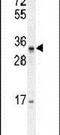 Pseudouridine Synthase Like 1 antibody, PA5-24048, Invitrogen Antibodies, Western Blot image 