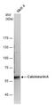 Protein Phosphatase 3 Catalytic Subunit Alpha antibody, PA5-29209, Invitrogen Antibodies, Western Blot image 