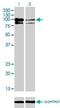 OCRL Inositol Polyphosphate-5-Phosphatase antibody, H00004952-M02, Novus Biologicals, Western Blot image 