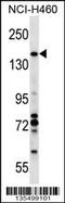 Valosin Containing Protein Interacting Protein 1 antibody, 58-368, ProSci, Western Blot image 