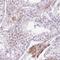 Zinc Finger Protein 35 antibody, NBP2-30842, Novus Biologicals, Immunohistochemistry paraffin image 