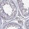 Tetratricopeptide Repeat Domain 23 antibody, NBP1-83717, Novus Biologicals, Immunohistochemistry frozen image 