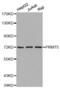 Protein Arginine Methyltransferase 5 antibody, abx001862, Abbexa, Western Blot image 