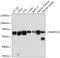 SWI/SNF Related, Matrix Associated, Actin Dependent Regulator Of Chromatin, Subfamily D, Member 2 antibody, A08109, Boster Biological Technology, Western Blot image 