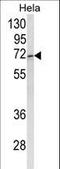 ASPSCR1 Tether For SLC2A4, UBX Domain Containing antibody, LS-B9022, Lifespan Biosciences, Western Blot image 