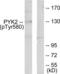 Protein Tyrosine Kinase 2 Beta antibody, LS-C199508, Lifespan Biosciences, Western Blot image 