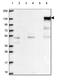 Inositol Polyphosphate-5-Phosphatase D antibody, HPA070455, Atlas Antibodies, Western Blot image 