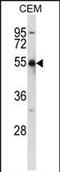 Potassium Voltage-Gated Channel Subfamily A Member 2 antibody, PA5-71910, Invitrogen Antibodies, Western Blot image 