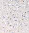 TNF Receptor Superfamily Member 6b antibody, PA1-30789, Invitrogen Antibodies, Immunohistochemistry paraffin image 