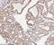 Annexin A3 antibody, M04796-2, Boster Biological Technology, Immunohistochemistry paraffin image 