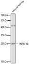 Tumor necrosis factor ligand superfamily member 10 antibody, A00466-3, Boster Biological Technology, Western Blot image 