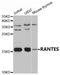 C-C Motif Chemokine Ligand 5 antibody, A00617, Boster Biological Technology, Western Blot image 