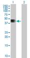 Zinc And Ring Finger 4 antibody, H00148066-B01P, Novus Biologicals, Western Blot image 