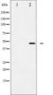 Jun Proto-Oncogene, AP-1 Transcription Factor Subunit antibody, TA325595, Origene, Western Blot image 