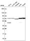 Double Zinc Ribbon And Ankyrin Repeat Domains 1 antibody, HPA064255, Atlas Antibodies, Western Blot image 