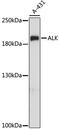 ALK Receptor Tyrosine Kinase antibody, 13-278, ProSci, Western Blot image 