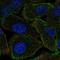 Protein Phosphatase 1 Regulatory Subunit 9A antibody, HPA075591, Atlas Antibodies, Immunofluorescence image 