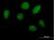 Homeobox A1 antibody, H00003198-B01P, Novus Biologicals, Immunofluorescence image 