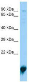 Phospholipase A2 Group XIIA antibody, TA329489, Origene, Western Blot image 