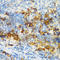 CD3d Molecule antibody, A1238, ABclonal Technology, Immunohistochemistry paraffin image 