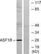 Anti-Silencing Function 1B Histone Chaperone antibody, A05211, Boster Biological Technology, Western Blot image 