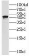 Stomatin Like 1 antibody, FNab08345, FineTest, Western Blot image 