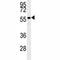 AKT Serine/Threonine Kinase 2 antibody, F40226-0.4ML, NSJ Bioreagents, Western Blot image 