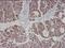 Actin Alpha 1, Skeletal Muscle antibody, orb95702, Biorbyt, Immunohistochemistry paraffin image 
