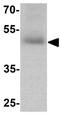 Solute Carrier Family 29 Member 2 antibody, GTX32150, GeneTex, Western Blot image 