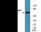 Estrogen Receptor 1 antibody, EKC2401, Boster Biological Technology, Western Blot image 